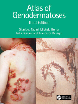 cover image of Atlas of Genodermatoses